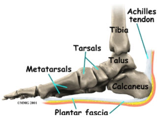 Plantar Fasciitis Redcliffe
